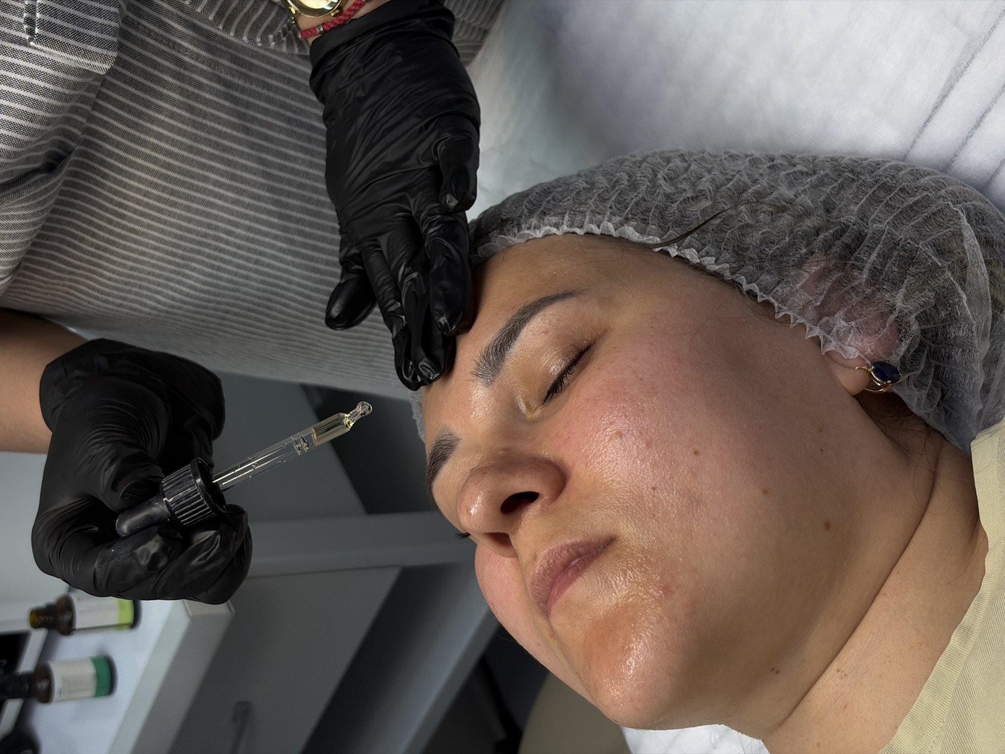 A woman wearing a disposable hairnet is lying on a white surface, receiving a facial treatment. The woman's eyes are closed and her skin appears to be moisturized. A person wearing black gloves is holding a pipette filled with a yellowish liquid over the woman's face, presumably applying the treatment. Another hand in a black glove is touching the woman's forehead. The person providing the treatment is wearing a striped shirt and a watch with a red wristband. In the background, there are several small bottles on a shelf. The location is likely a salon or spa in Chaikovsky, Russia.