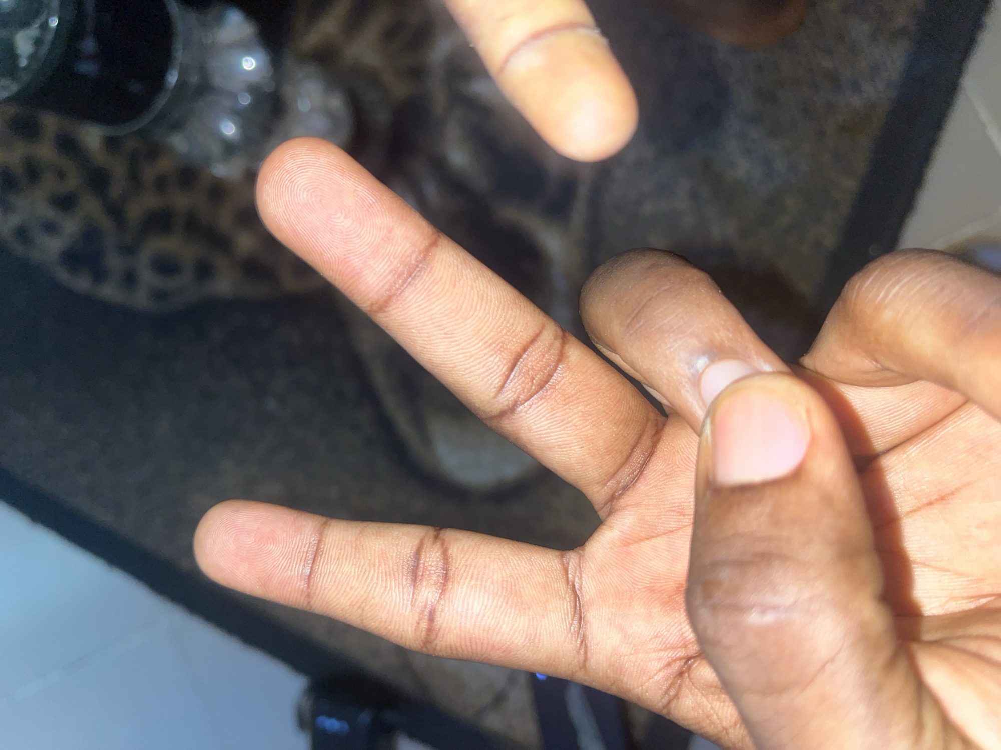 A close-up, top-down view shows a person's right hand in the foreground, with their index and middle fingers extended in a peace sign, while their thumb and ring finger are partially visible. The skin tone of the hand is dark brown, and visible fingerprint patterns are present on the fingers. The hand is positioned over a textured, dark surface, possibly a rug or carpet, which appears to have a leopard-print pattern. In the blurred background, a clear glass jar with a metallic lid is visible, as well as a portion of a blue-tinted surface that could be a wall or furniture. The lighting suggests an indoor environment. The location is identified as Jalingo, Nigeria.