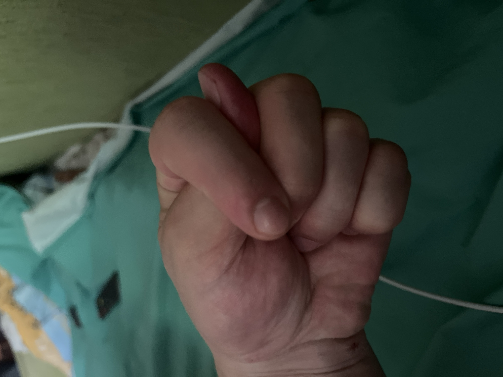 The image displays a close-up, slightly overhead view of a human hand clenched into a fist. The fingers are curled tightly, with the thumb resting over the top of the index and middle fingers. The little finger appears somewhat more extended than the others and shows a reddish tint, possibly from pressure or circulation.
The background is largely out of focus, dominated by a soft, dark green fabric, which could be clothing, bedding, or medical scrubs, suggesting an indoor setting. A thin, white wire or cord stretches across the lower portion of the frame, passing in front of the hand and extending towards the right. Blurry shapes and lighter green tones are faintly visible in the indistinct background.
There is no specific activity taking place beyond the hand being held in a clenched fist. The lighting appears subdued, typical of an indoor environment, making it impossible to determine the time of day or external weather. No visible text is present in the image. While the location context of Minsk, Belarus is provided, there are no visual cues within the image itself to confirm this specific location.
