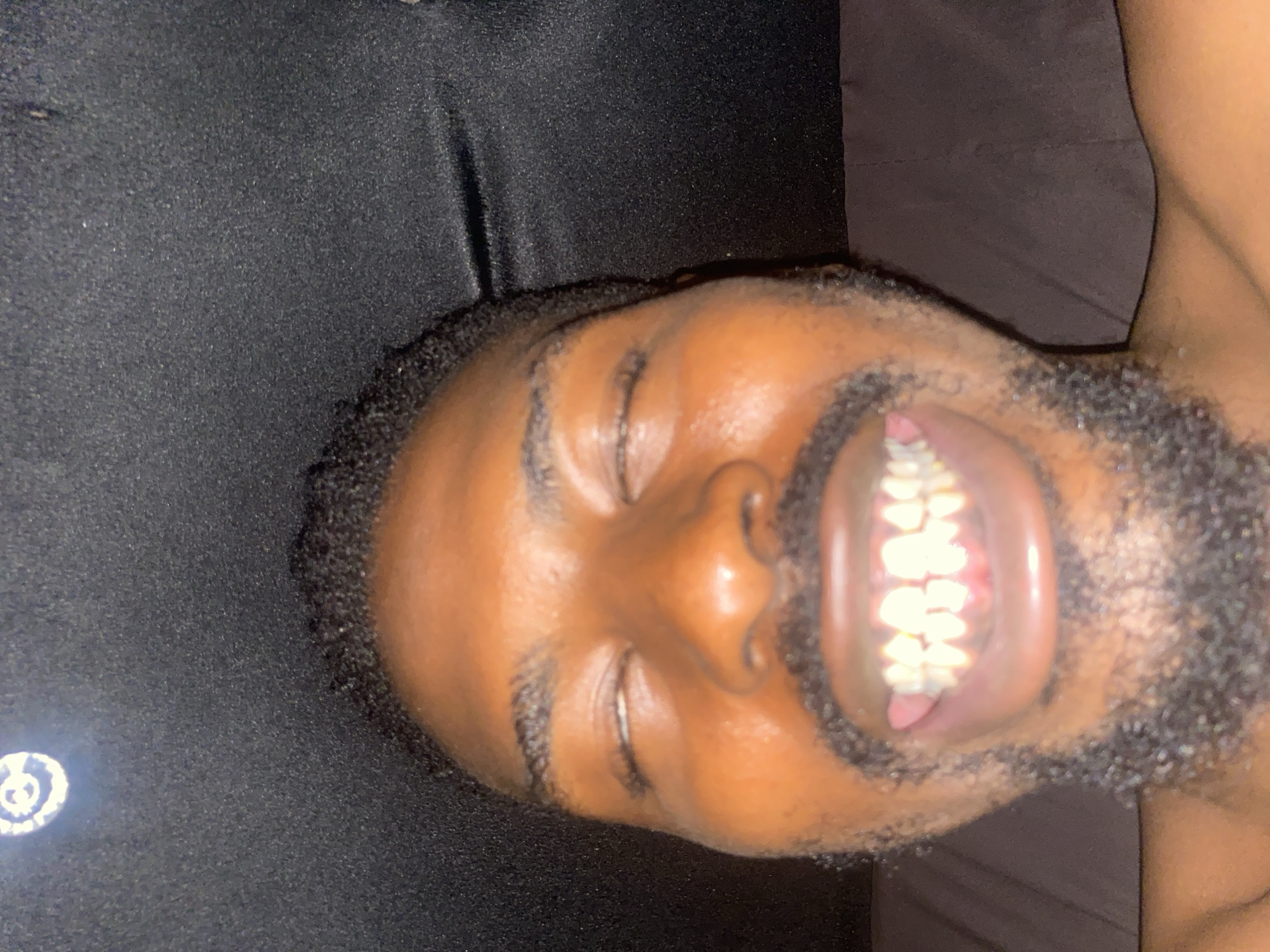 The image displays a headshot of an adult person, likely male, with dark skin, short dark hair, and a beard, lying down with his head tilted. His eyes are closed or squinting, and his mouth is wide open, revealing a full set of bright, white/yellowish teeth, along with his gums and tongue.
The subject is resting on a dark, textured fabric, possibly a blanket or bedsheet. To the left of his head (in the current orientation of the image), there is a small, circular, glowing white object with a dark, stylized symbol in its center, resembling a partial spiral or letter 'C'. A second, plainer dark fabric surface, possibly a pillow or headboard, is visible in the upper right background.
The lighting is dim, suggesting an indoor setting with artificial light strongly illuminating the subject's face and teeth, creating prominent highlights on his skin. The image is rotated 90 degrees counter-clockwise. The expression, with closed eyes and a wide-open mouth, could suggest laughter, shouting, or simply a posed moment. No other distinct text is visible apart from the symbol on the glowing object. The location context for the image is Barakin Akawo, Nigeria.