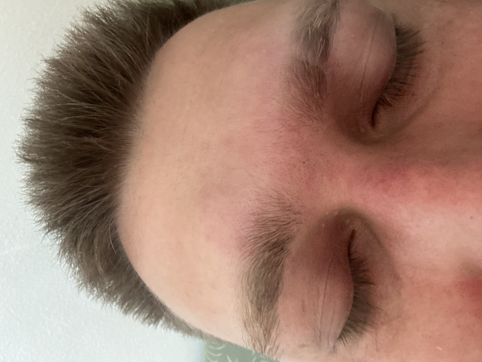 A close-up, low-angle shot shows the closed eyes and forehead of a person with light brown hair. The skin on the forehead is slightly reddish. The background is a pale, textured surface, possibly a wall. There are no discernible landmarks or features that would allow for identification of a specific location within the city of Zvezdara Urban Municipality, Serbia.