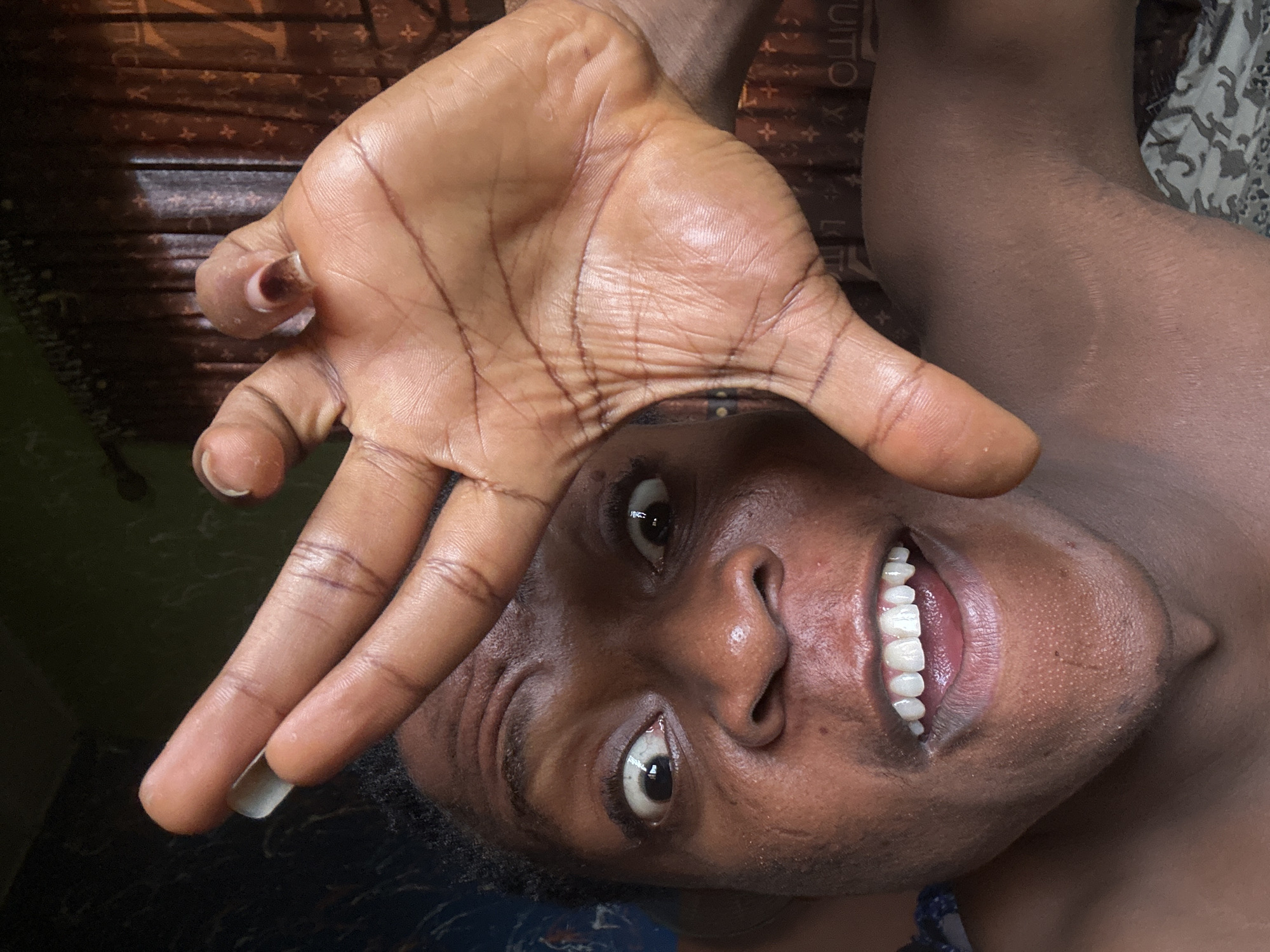A close-up, upward-angled shot features a person of color with dark skin, showcasing their face and right hand. The person is smiling, revealing white teeth. The right hand is positioned over their face with fingers spread. The person has dark hair. The background includes a brown surface patterned with logos, and a green wall. The location is Unknown, Unknown.