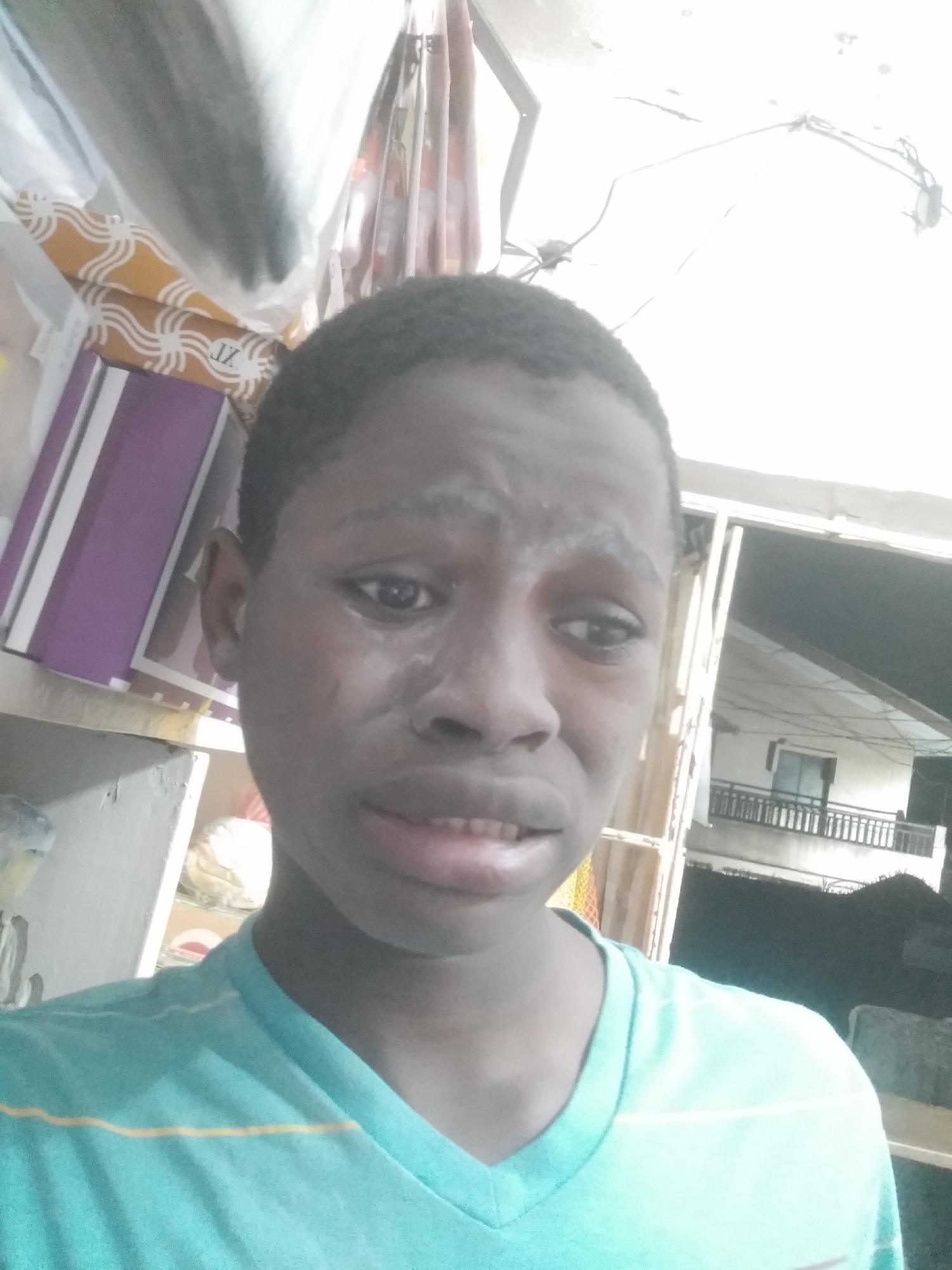 A close-up photograph shows a young dark-skinned person with short, dark hair wearing a teal V-neck t-shirt with yellow stripes. The person’s face appears to have a white substance on it, possibly lotion or cream. The expression is somber.
Behind the person, on the left, are shelves with books, papers, and other objects. The background is brightly lit, and a window reveals the exterior of a building across the street. Based on the information provided, the location is Shangisha, Nigeria. The time of day is either late afternoon or early evening.