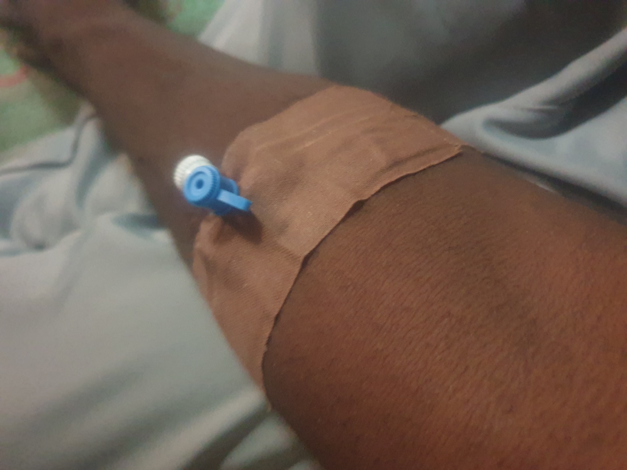 A close-up, downward-angle shot shows a person's arm with an IV catheter inserted. The catheter has a blue plastic hub with a white cap. It is secured to the arm with a tan-colored adhesive bandage. The surrounding environment appears to be a bed with light blue and patterned sheets. The skin tone of the arm is dark.