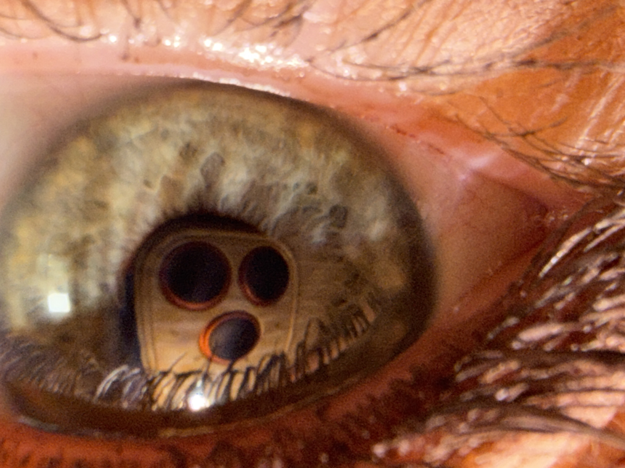 This is an extreme close-up macro photograph of a human eye, likely a hazel or green eye due to the brown and green flecks visible in the iris. The reflection in the pupil is the most striking element. It shows a close-up view of a security camera, specifically the lens assembly with three distinct circular openings. These openings are dark and appear to have a red or orange ring around them. The reflection is distorted, as expected from the curved surface of the eye.
The surrounding skin of the eye area is visible, including the upper eyelid with eyelashes and the eyebrow hairs. The skin texture is detailed, showing pores and fine lines, suggesting natural lighting. The reflection in the pupil appears sharp, indicating a bright light source illuminating the camera. The overall impression is a juxtaposition of the organic complexity of the human eye with the technological starkness of the security camera. There is no visible text in the image. The context of the shot appears to be a controlled environment, given the focus and detail, rather than an outdoor or spontaneous scene. The mood evoked is one of observation, perhaps even surveillance, due to the prominent camera reflection.