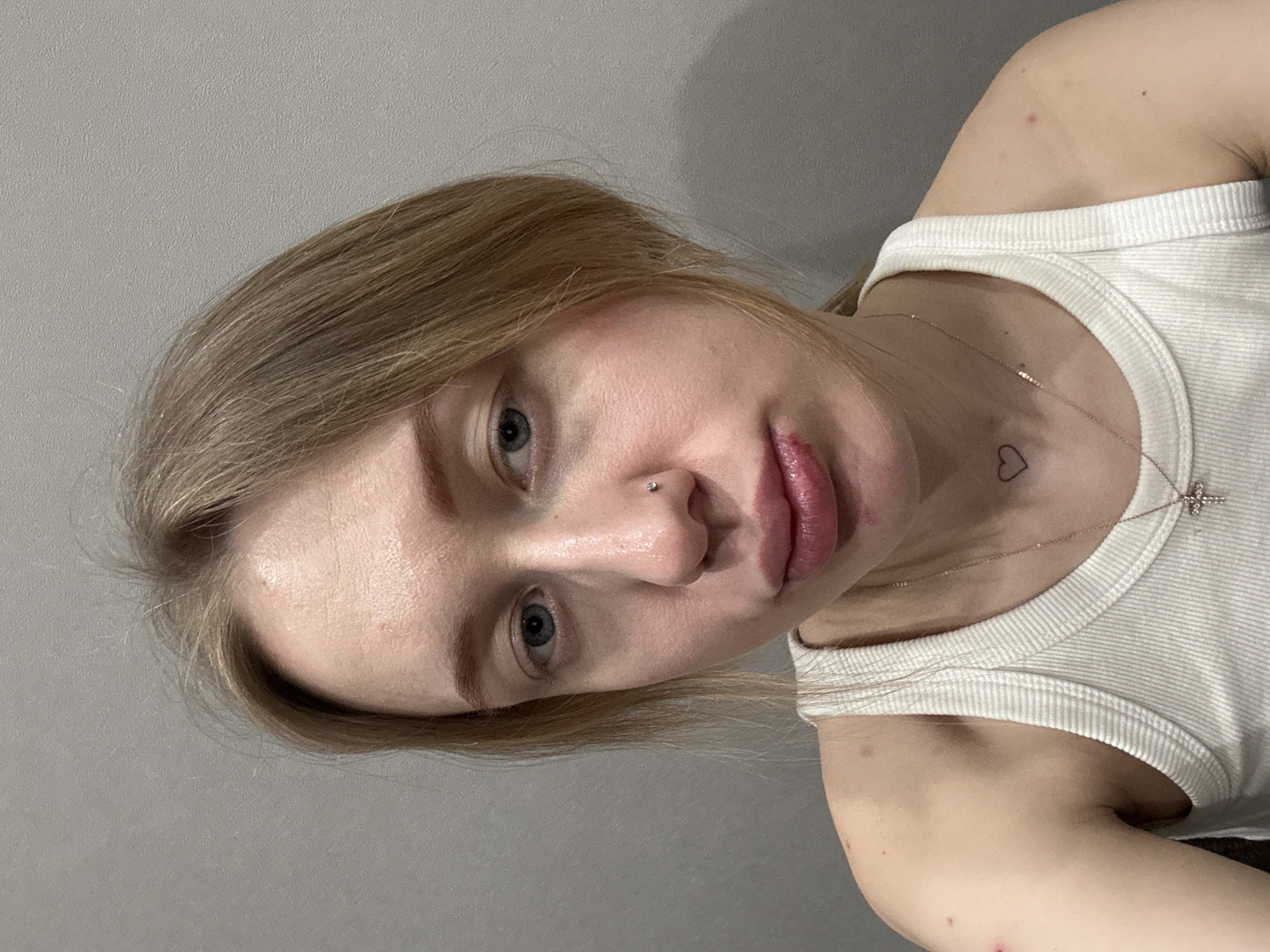 The image presents a close-up portrait of a female subject positioned against a plain, light gray wall, indicating an indoor setting. The subject has light brown hair, blue eyes, and fair skin. Her gaze is directed straight at the camera. A small, silver-colored stud is visible in her left nostril. There is noticeable periorbital discoloration, consistent with bruising, present beneath both eyes. Her lips appear swollen, with a distinct reddish-brown lesion or wound evident on the central-left portion of her lower lip. She is wearing a white ribbed tank top. A thin, gold-colored chain necklace with a small cross pendant is visible around her neck. A black outline tattoo of a heart is present on her left clavicle area. Small red lesions are visible on her left shoulder, and a darker mole is visible above her right clavicle. The specific location within the city of Rostov-on-Don, Russia, cannot be determined from the visual information provided.