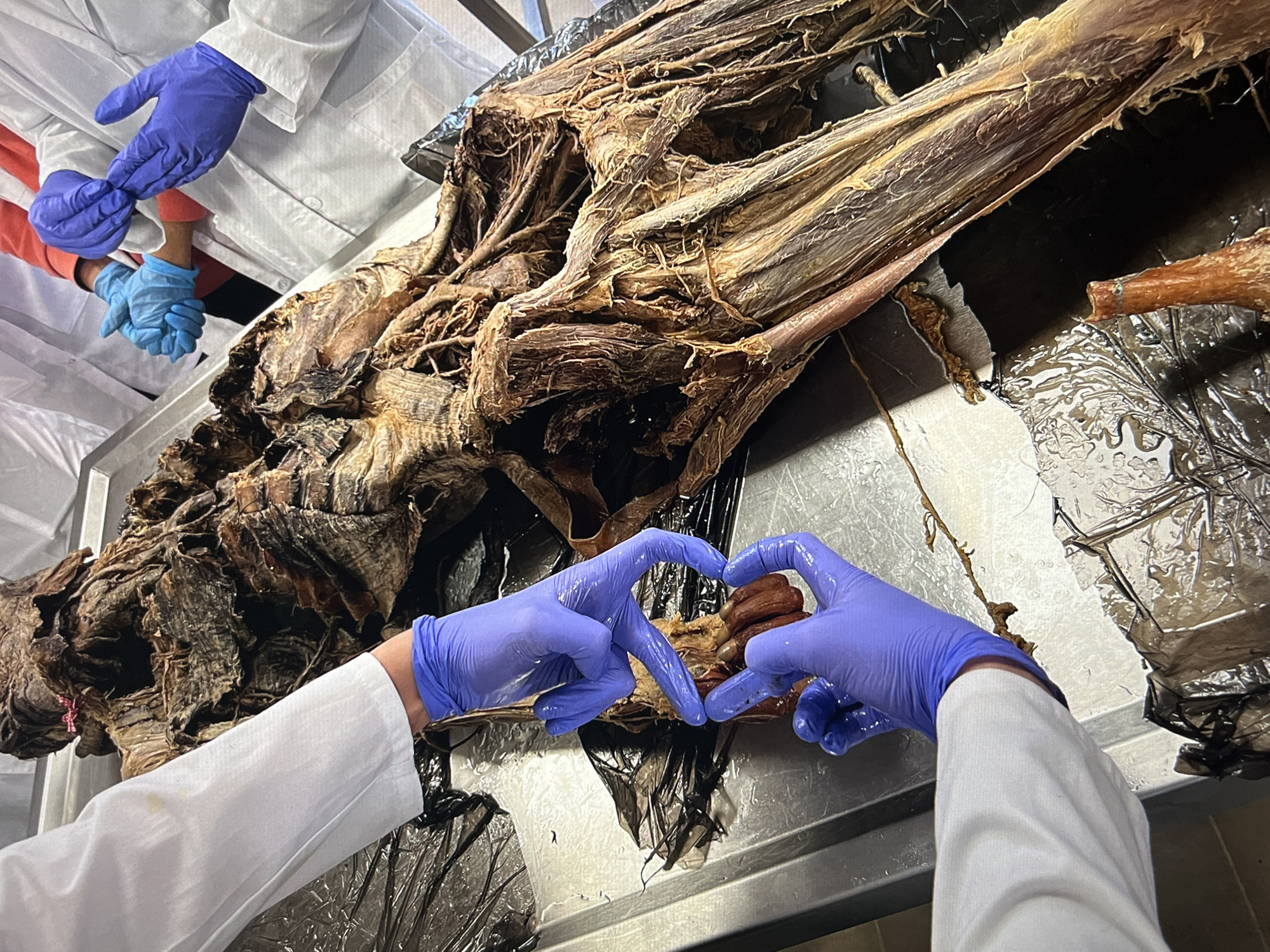The image shows a cadaveric dissection on a metal table. The dissected body, consisting of exposed muscles and connective tissue, is centrally located. Two gloved hands form a heart shape over a section of the dissection. To the left, other individuals wearing lab coats and gloves are partially visible. The environment appears to be a laboratory or anatomy lab.