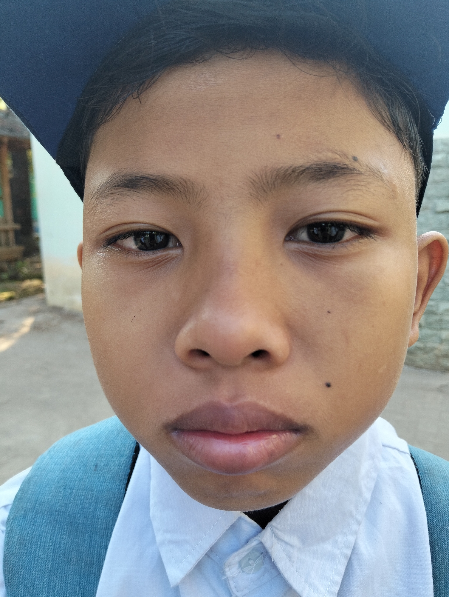 A close-up, eye-level, outdoor portrait of a young boy wearing a blue graduation cap and a white collared shirt with a blue backpack strap visible. The boy's face is turned towards the camera, with his eyes open and looking forward. He has dark hair and brown eyes. There are two moles visible on his face, one on his forehead and one on his cheek. The background is blurred and appears to be a street scene in Paciran, Indonesia, with a light-colored wall and some greenery visible. The lighting suggests it is daytime, with some dappled sunlight on the ground.