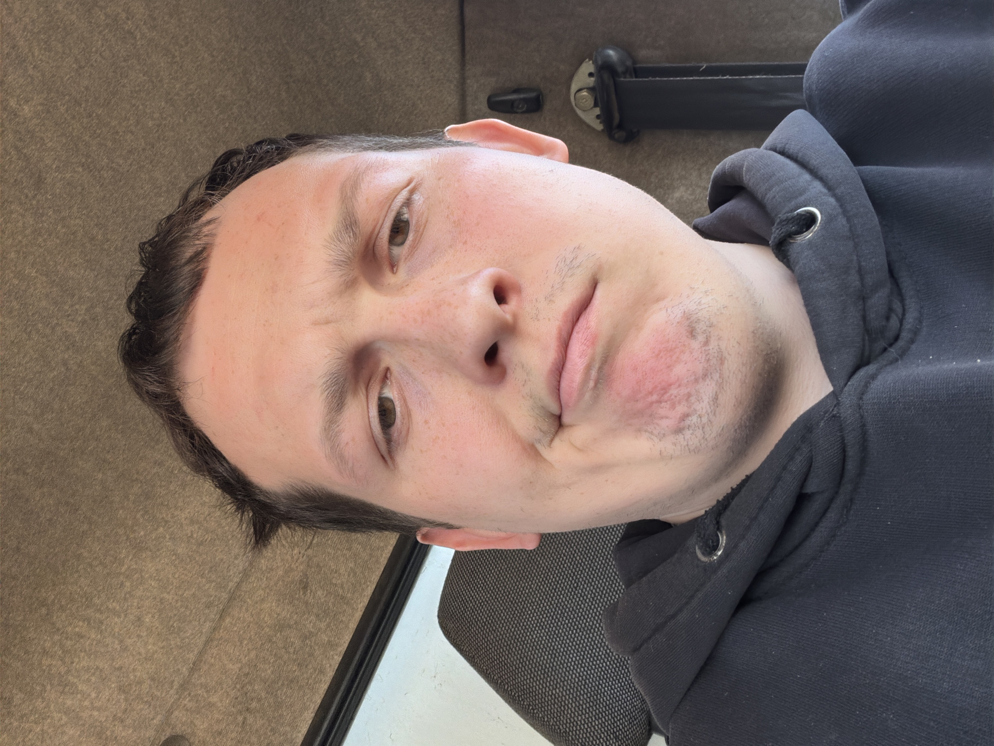 A medium-shot, selfie-style photograph depicts a light-skinned male with short, dark hair and stubble wearing a dark hooded sweatshirt. He is positioned at an angle, with his face slightly tilted and a neutral to mildly displeased expression. His right cheek and jawline appear reddish, possibly indicating irritation or mild inflammation.
The background is indistinct but suggests an interior space, with a beige or light brown surface visible behind the subject's head. A dark object, resembling a seatbelt mechanism, is partly visible in the upper background. A section of a seat is visible on the bottom left, indicating the individual is likely sitting in a vehicle or seat.
There is no indication of the location being in the city of Chaikovsky, Russia or any other specific location.