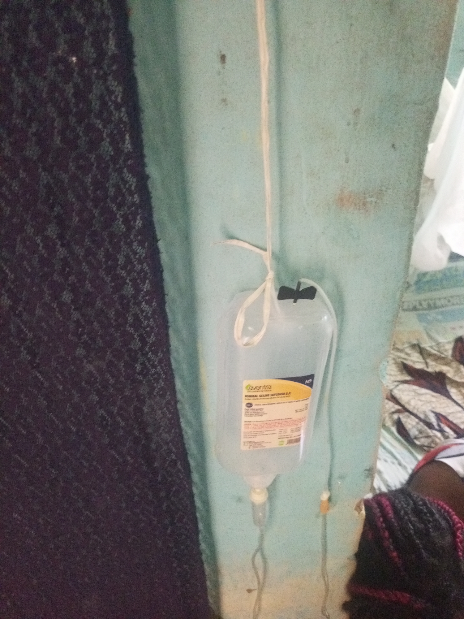 This media file captures a close-up view of an intravenous (IV) drip bag hanging from a light blue wall. The bag appears to be filled with a clear liquid, and a white string is used to suspend it. A black clamp is visible on the tubing. The IV bag has a label with text, including the brand name "aventra" and "NORMAL SALINE INFUSION S.P.". There are also other lines of text on the label, some of which are difficult to read due to the image resolution.
To the left of the IV drip, a dark, textured fabric is visible, possibly a blanket or clothing. To the right, there are hints of a patterned fabric, possibly bedding or a cloth, and a person's braided hair, featuring dark brown and reddish-pink strands. The overall scene suggests a medical setting, likely a healthcare facility or a home where someone is receiving medical treatment. The wall appears somewhat aged, with some discoloration and marks, suggesting a possibly utilitarian or less-than-pristine environment.
The presence of the IV drip indicates a medical procedure is underway, likely for hydration or administering medication. No specific time of day or weather conditions can be inferred from the image. The overall mood is neutral, focusing on the medical equipment and the immediate surroundings. The visible text confirms the type of fluid being administered. The location context of Jalingo, Nigeria, adds a layer of cultural and geographical specificity to the scene.