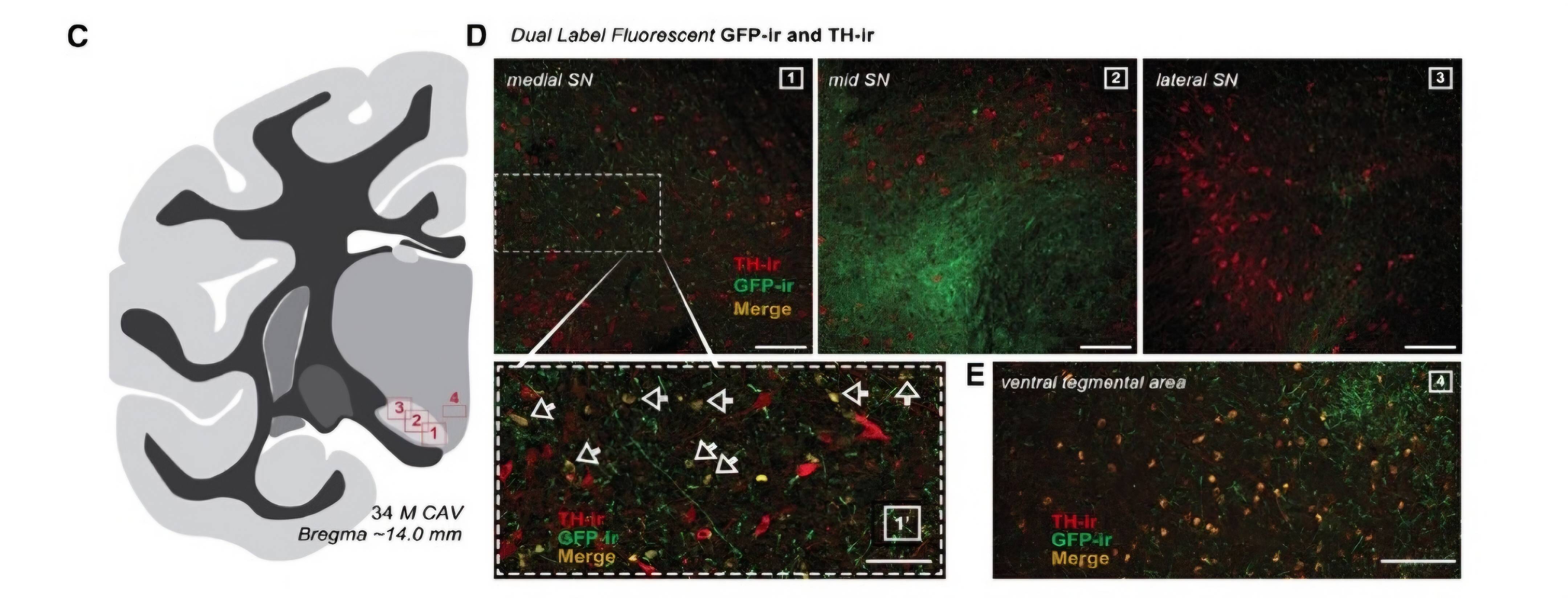New Hope for PD: Gene Therapy Blocks Dyskinesia in Monkeys