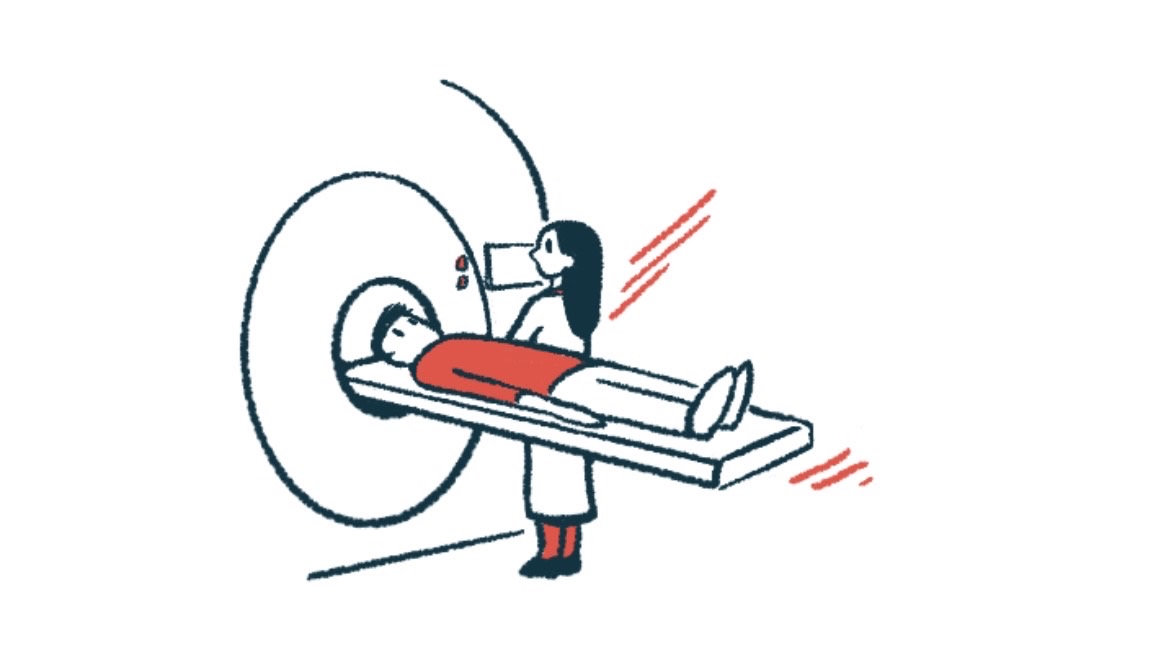 Focused ultrasound to treat Parkinson’s available soon at VUMC