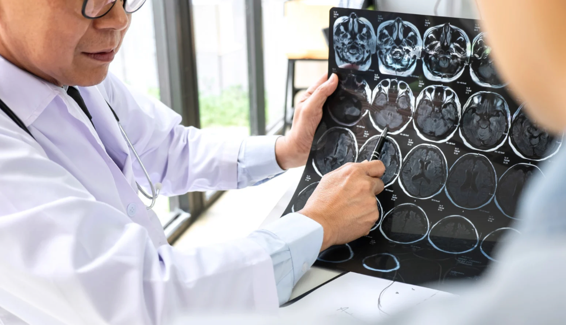 FDA clears brain mapping tool for neuromodulation therapies