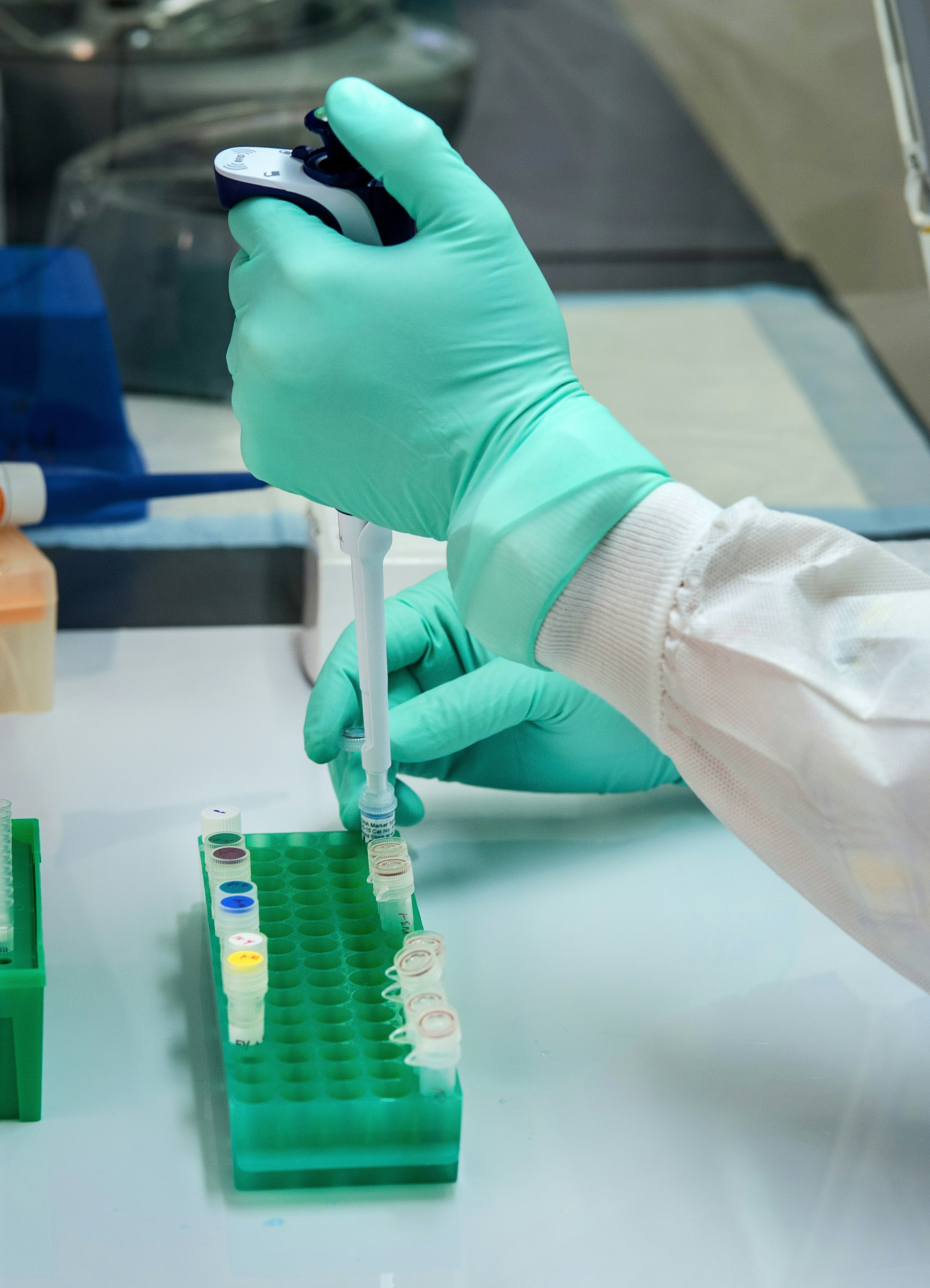New mouse model captures disease progression, from gut to brain