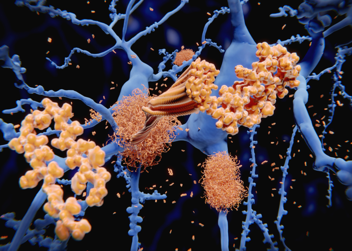 BPGbio, University of Oxford team up on treatments for Parkinson’s