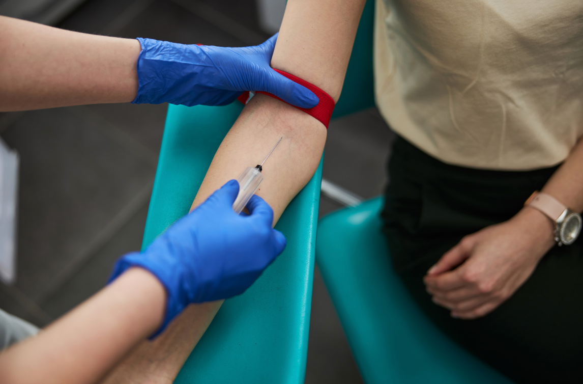 Sunbird Bio blood test may yield accurate Parkinson’s diagnosis