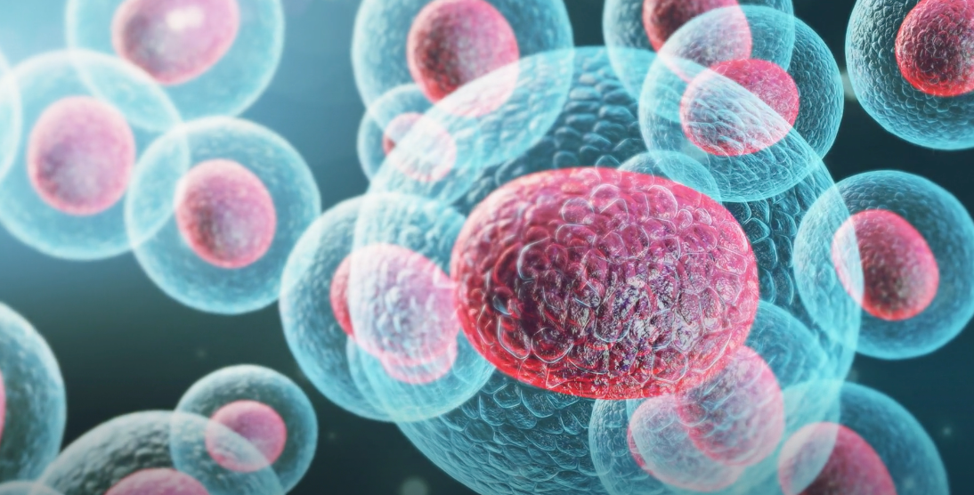 BlueRock Therapeutics advances investigational cell therapy bemdaneprocel for treating Parkinson’s disease to registrational Phase III clinical trial