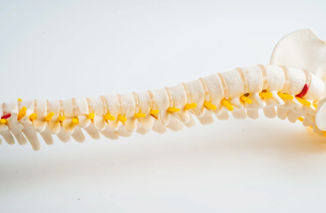 Spinal Cord Stimulation Failed to Improve Parkinson’s Disease Symptoms in Randomized Crossover Double-Blinded Evaluation