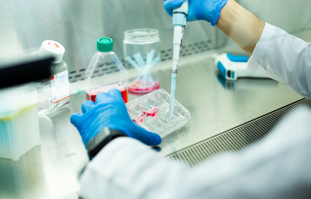 Cell Therapy in Parkinson Disease: Bemdaneprocel and What Lies Ahead