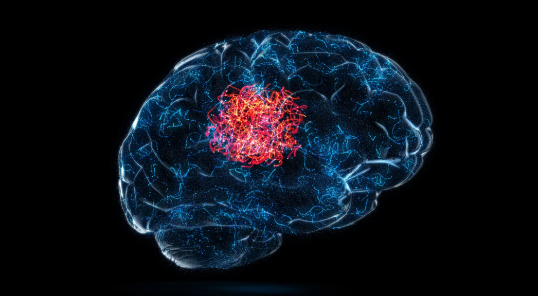 A Wireless Implant for Alleviating Parkinson's Disease Symptoms