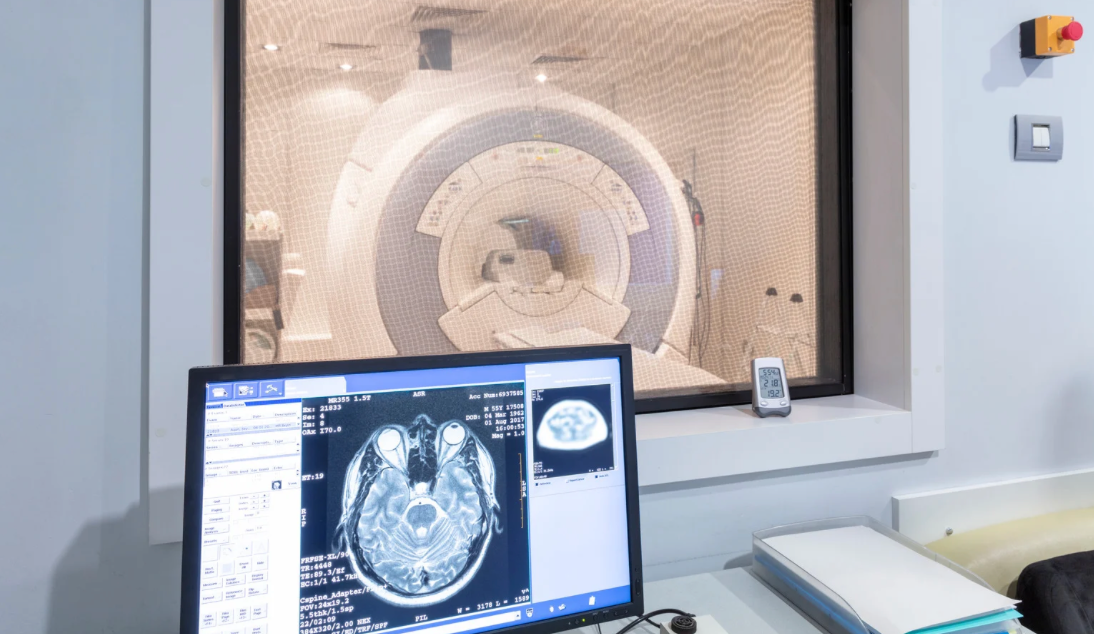 Insightec Announces FDA Approval of Staged Bilateral Focused Ultrasound Treatment for Parkinson's Disease