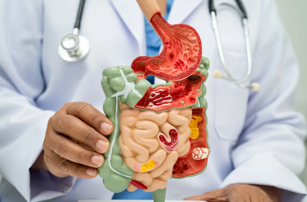 Gastrointestinal Involvement in Parkinson Disease and Its Impact on Levodopa Efficacy