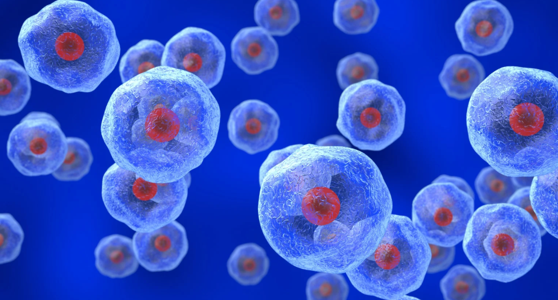 Promising Long-Term Results for a New Parkinson’s Cell Therapy