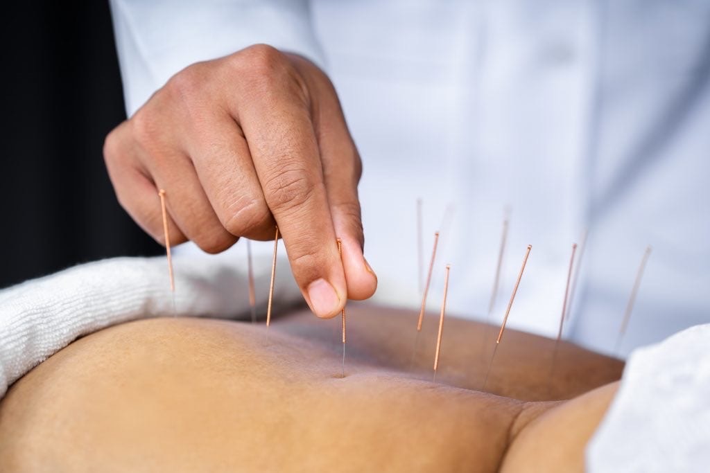 Exploring therapeutic treatments for Parkinson’s disease