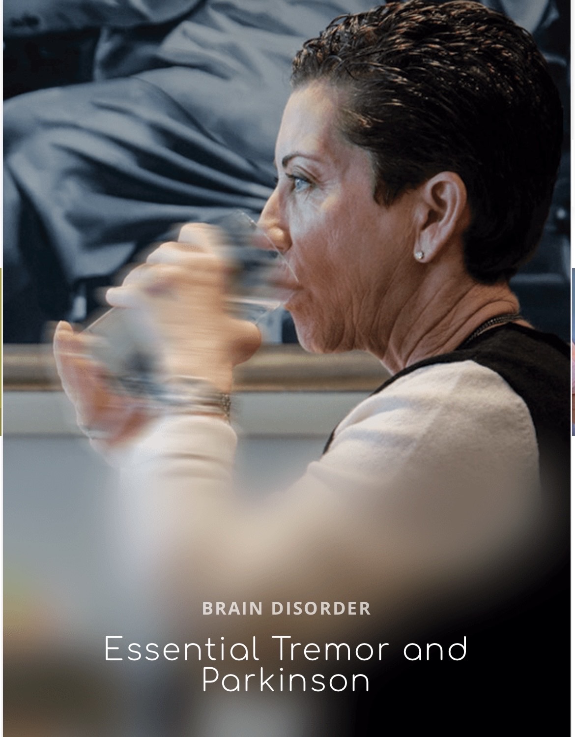 ResoFus Alomar Treatment for Essential Tremor and Parkinson's Disease