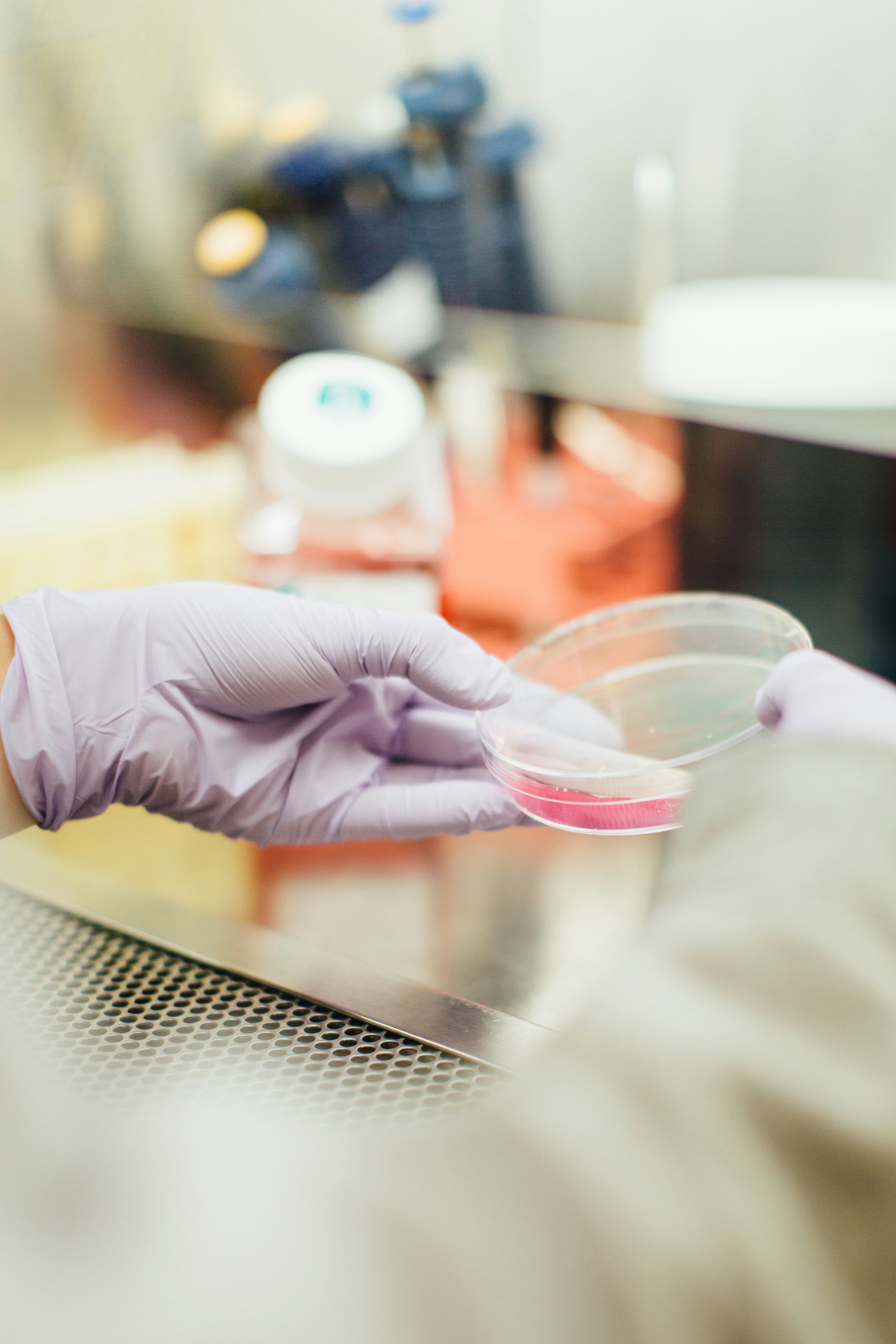 1st transplant done in trial of Parkinson’s cell therapy ANPD001