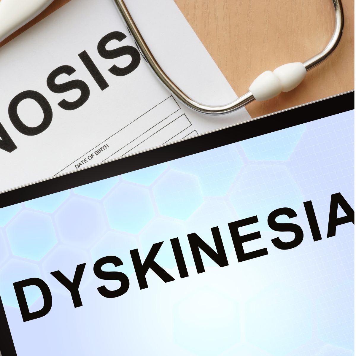 Add-on tavapadon eases symptoms in late Parkinson's, data show