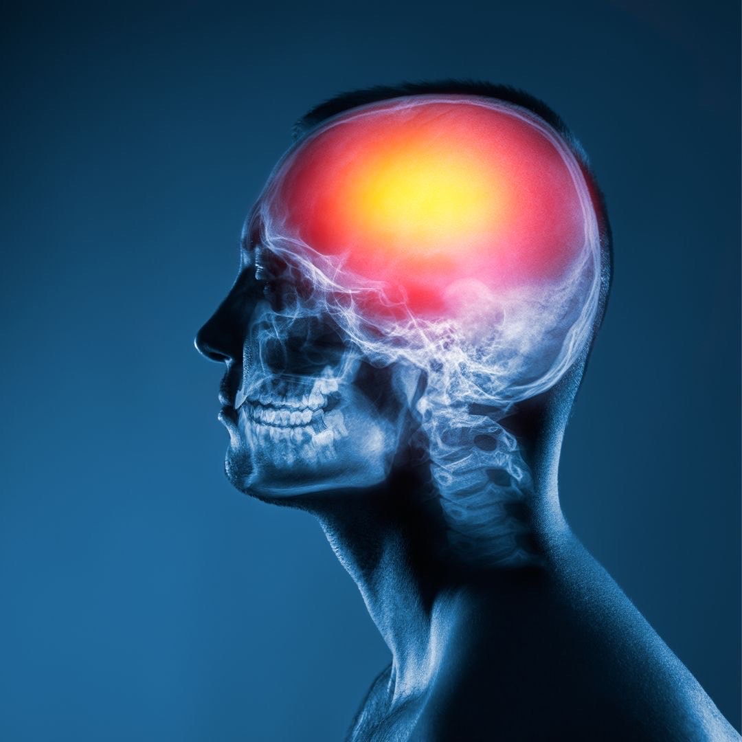 DBS reduces toxic clumping in Parkinson's rat brain cells
