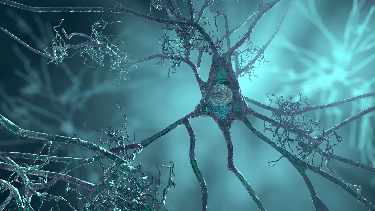 Uncovering Hidden Pathways in Parkinson’s Disease Progression