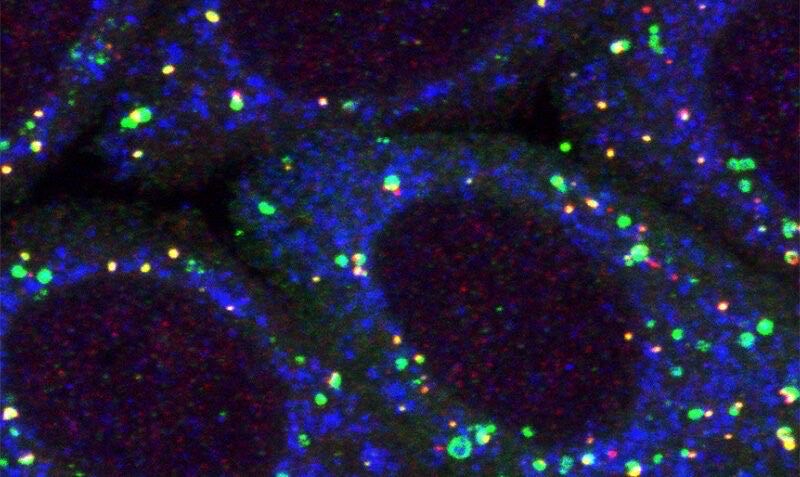 Protein discovery linked to Parkinson’s disease opens future research areas