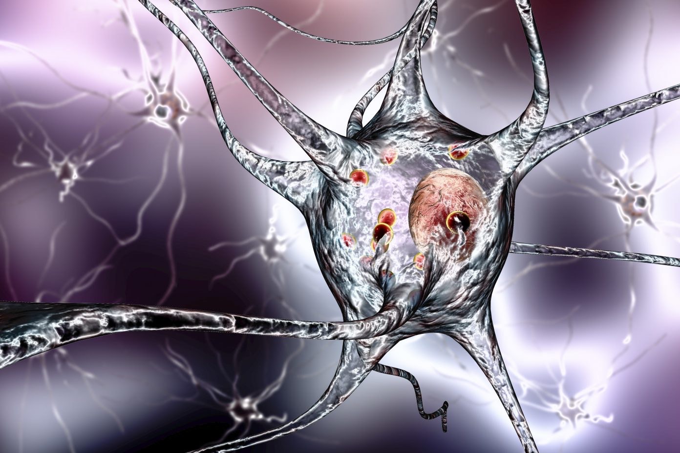 A protein called Neurofilament Light Chain can help identify early signs of Parkinson's and dementia.