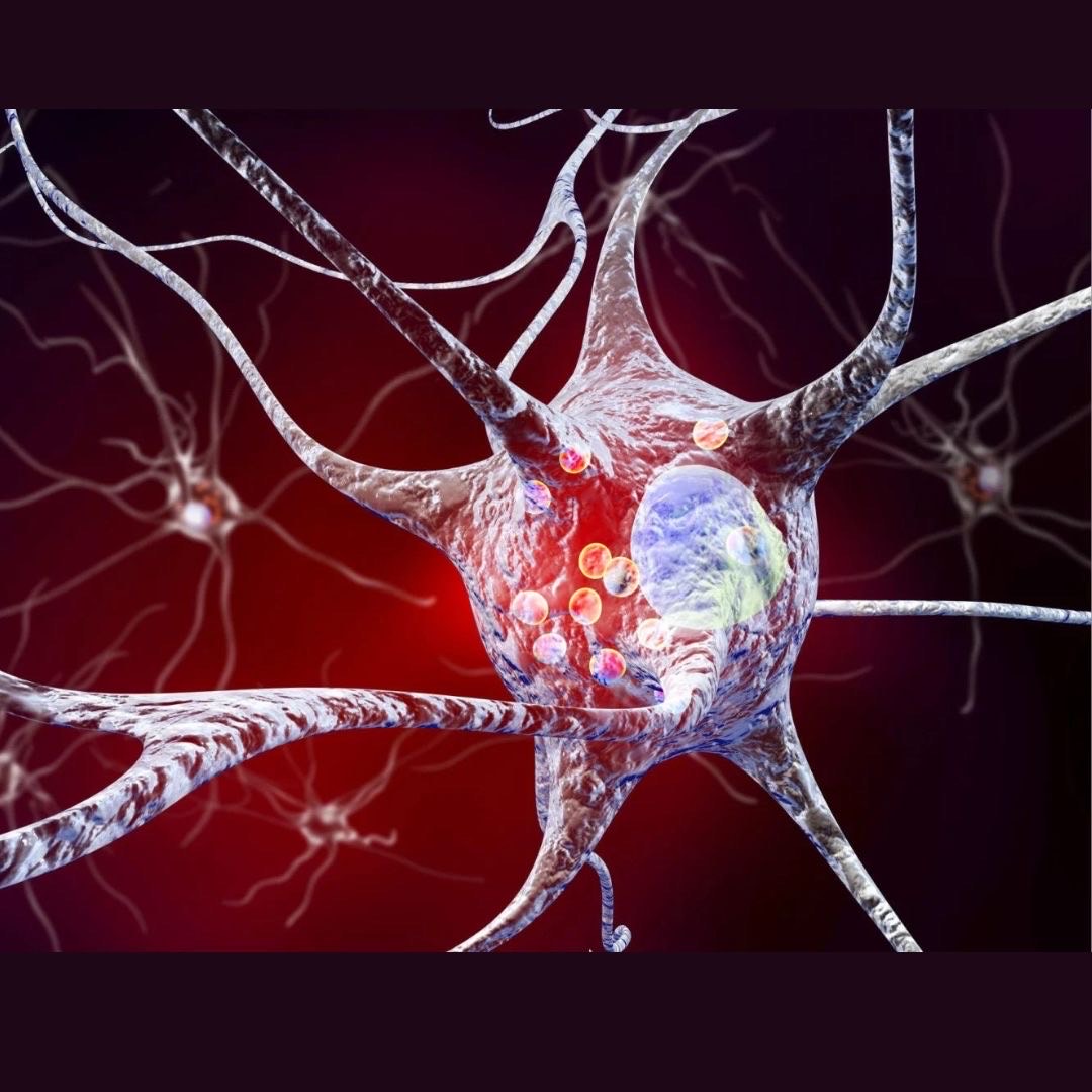 Breakthrough Discovery Links Immune System to Parkinson’s Progression