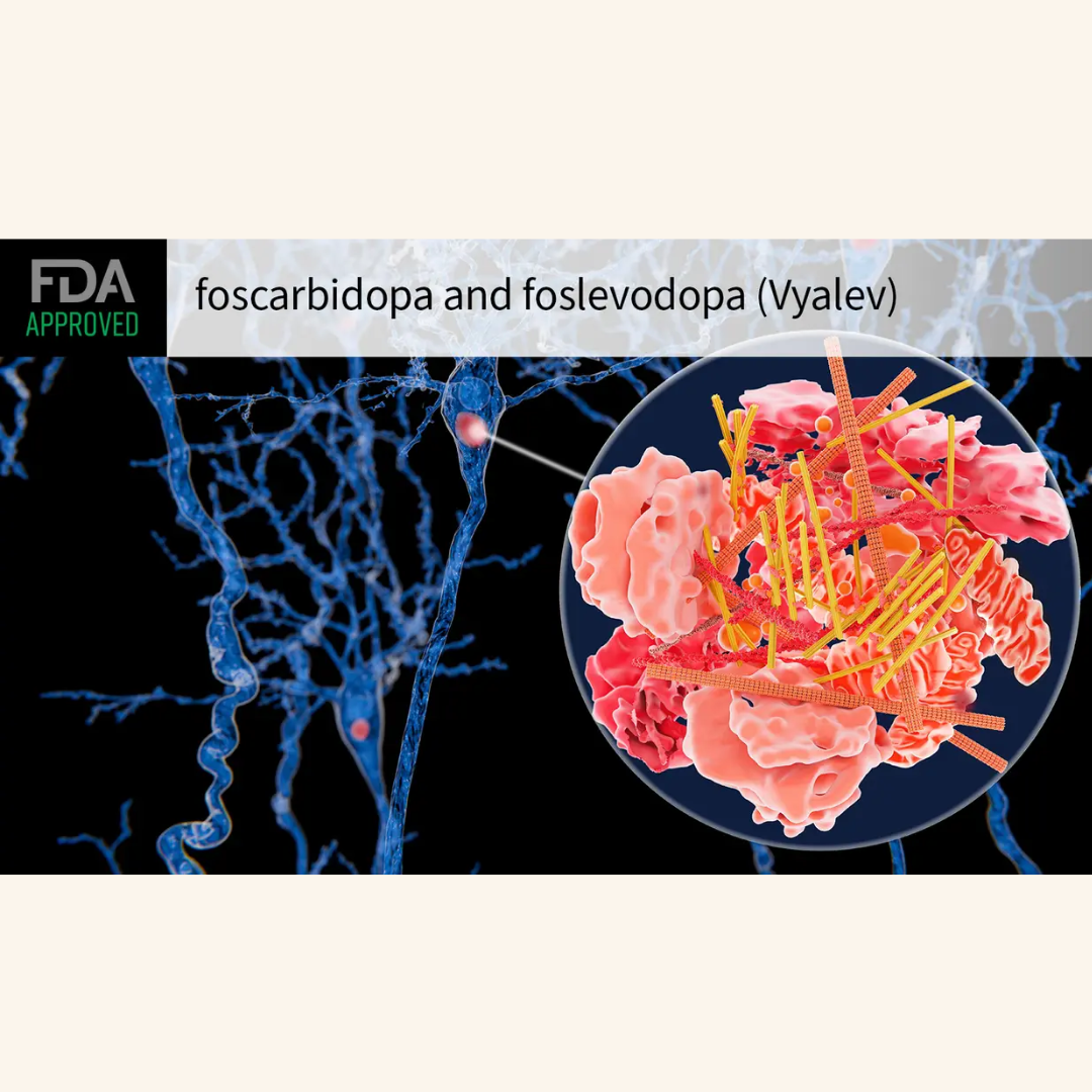 New 24-Hour Parkinson’s Treatment Approved by FDA: What You Need to Know About VYALEV