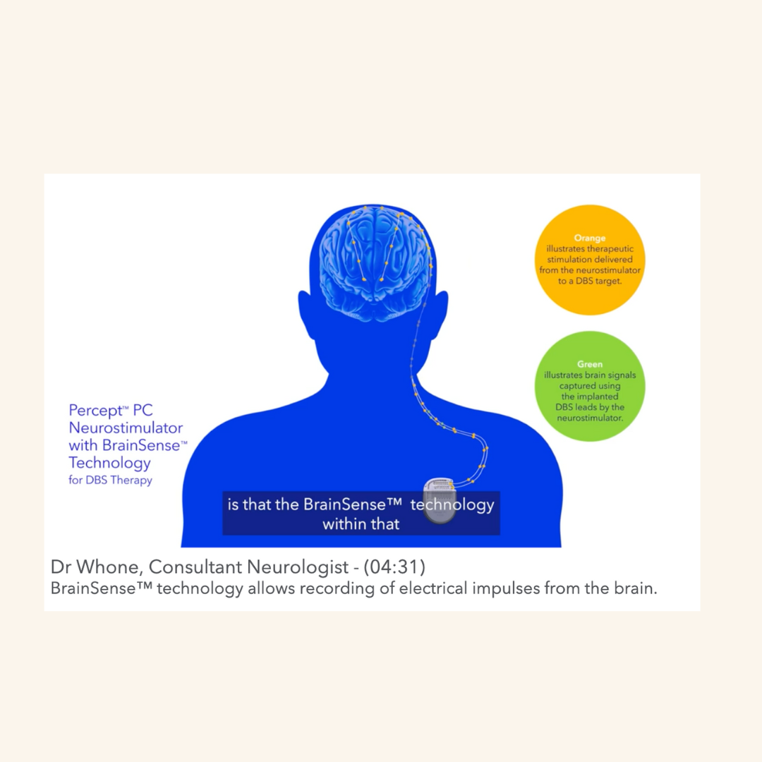 FDA approves fully asleep DBS surgical procedure by Medtronic