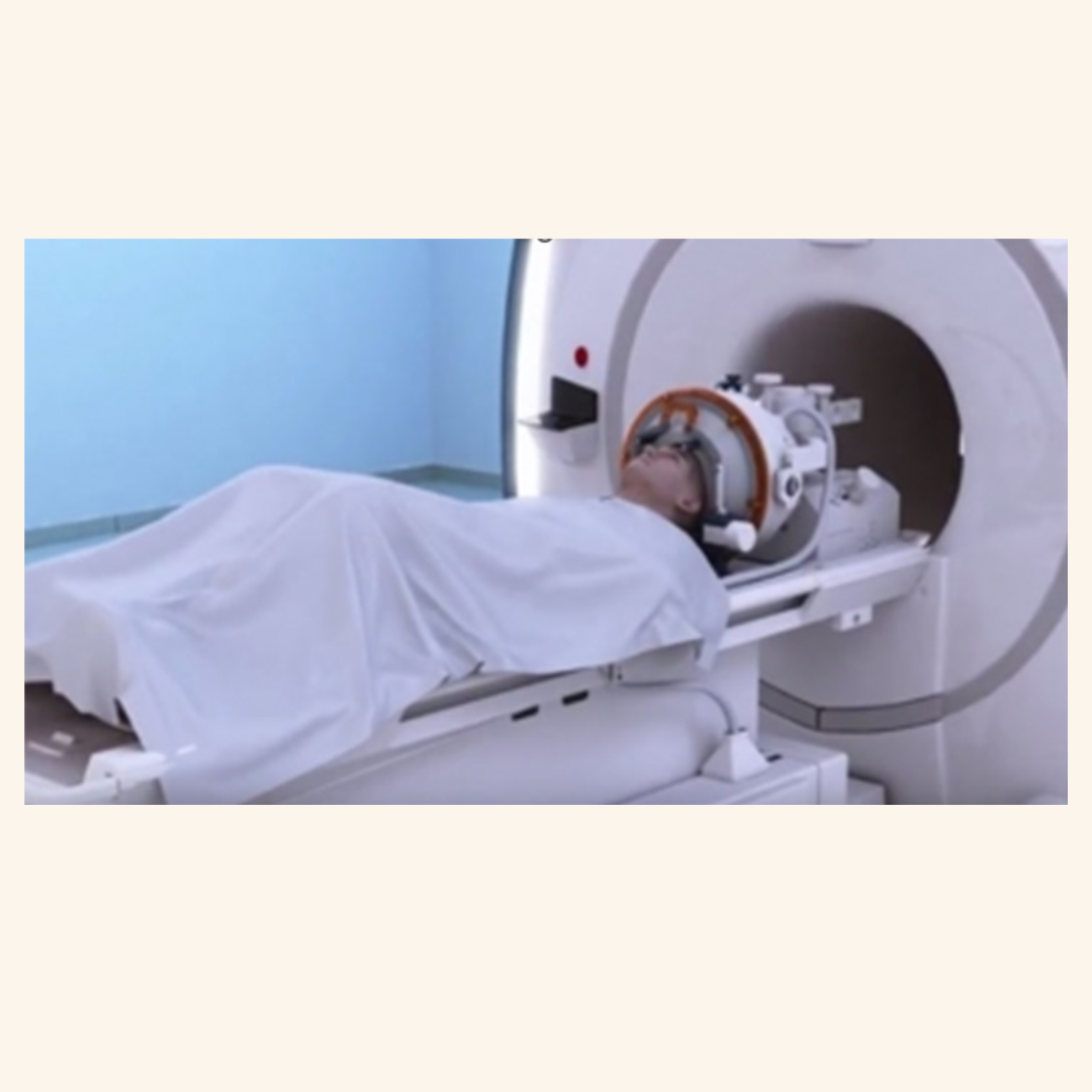 Focused Ultrasound for Parkinson’s Disease: A Promising Alternative Therapy