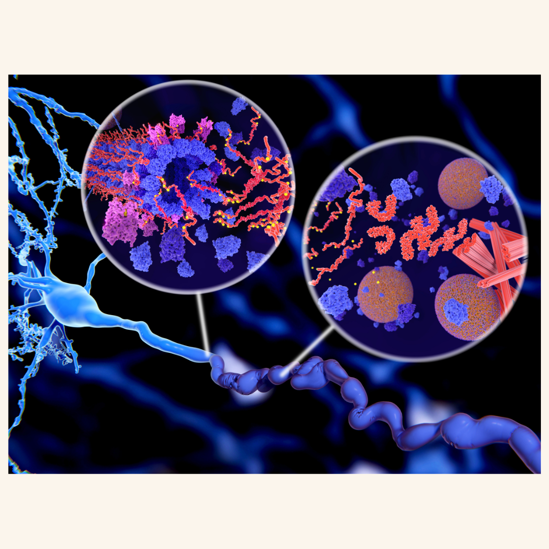 Can Proteins Help Protect the Brain in Parkinson’s Disease?