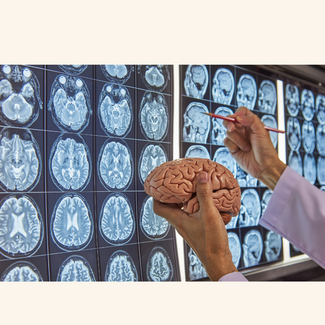 Could Tiny Nanocarriers Be the Key to Beating Parkinson’s?
