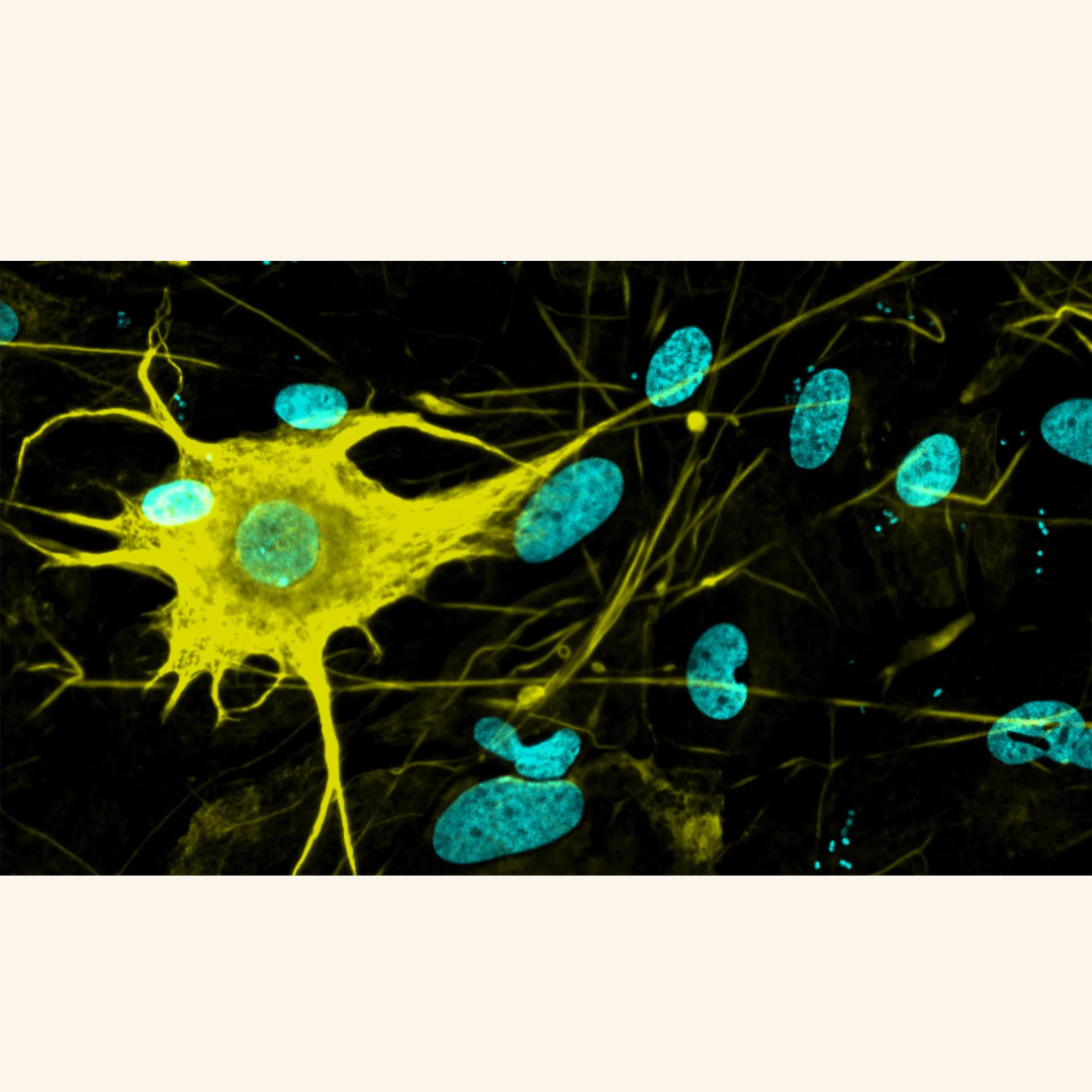 Scientists Grow Over 400 Types of Brain Cells in the Lab – Big Step for Parkinson’s Research