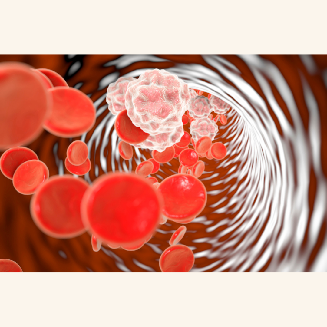 Parkinson’s and Diet: Large Study Finds No Link to Inflammatory Foods