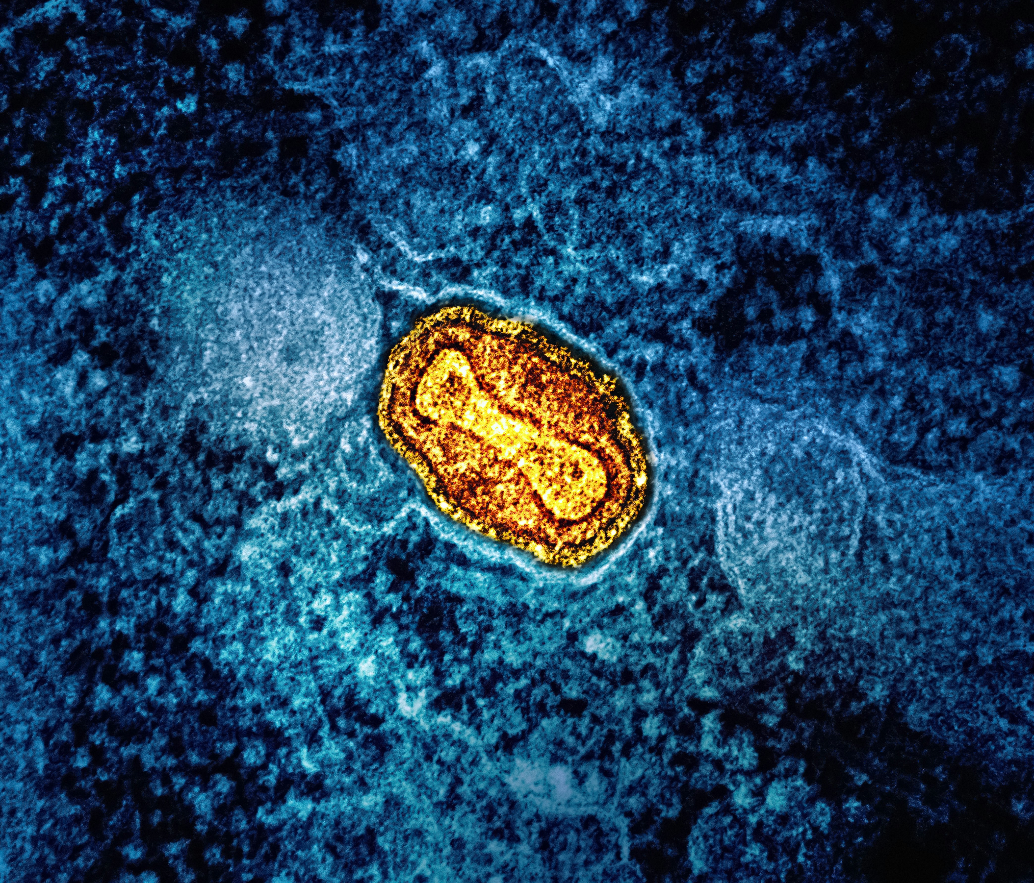 Rescue Mission: How Cells Might Save Their Power Plants—And What That Means for Parkinson’s