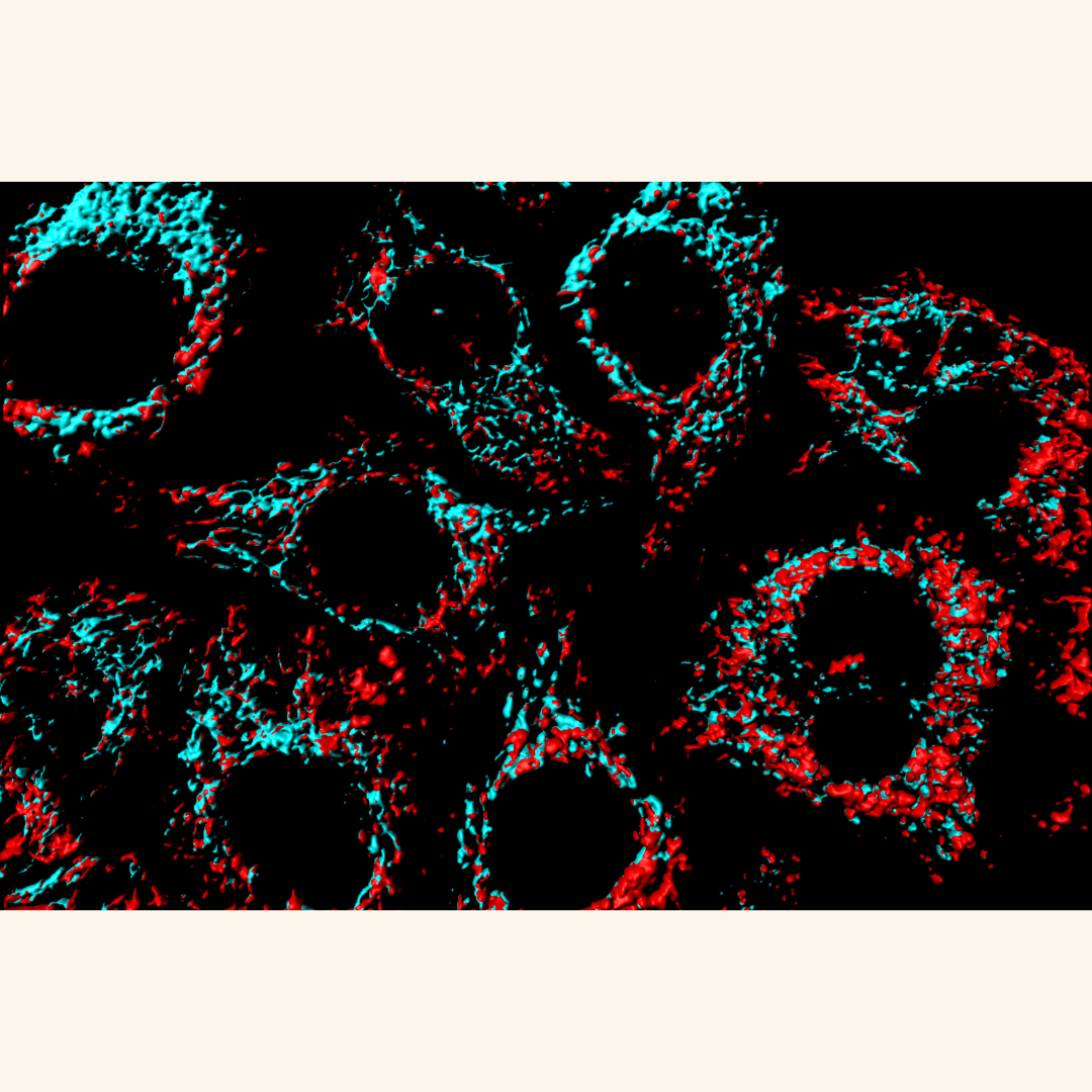 The new “clean-up switch” that could protect brain cells in Parkinson’s