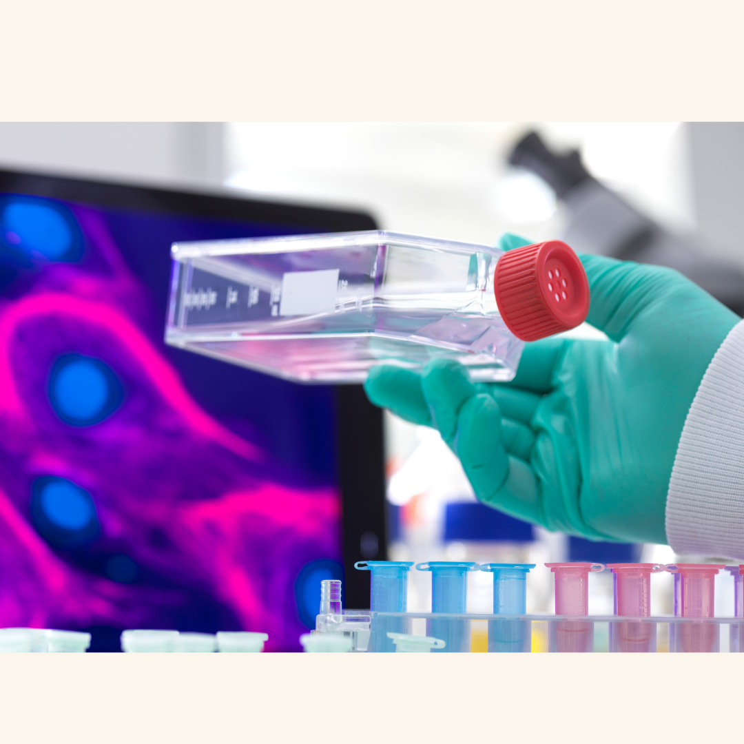 Early Cell Therapy Results in Parkinson’s Show Measurable Gains