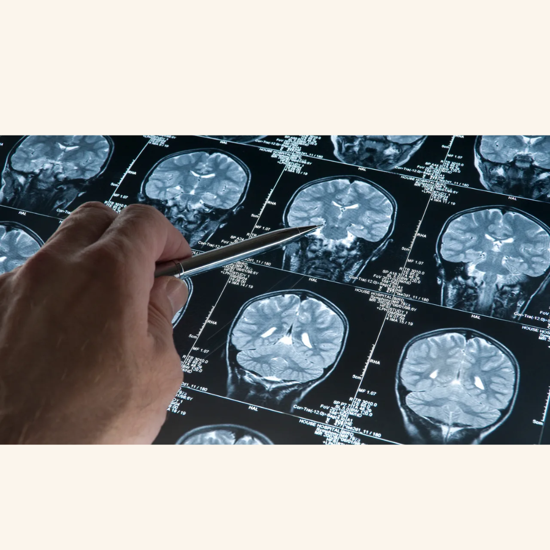 Women’s brains show surprising protection early on — and estrogen related genes may be why