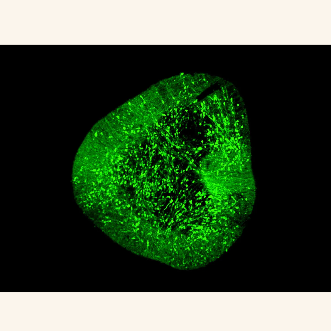 A new brain atlas opens a clearer path for Parkinson’s treatment