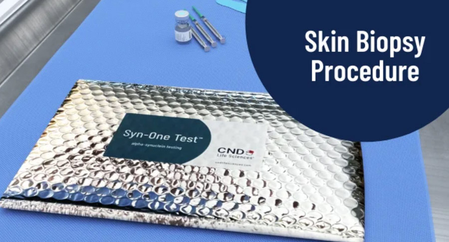 Simple Skin Test Shows Early Promise in Tracking Parkinson’s Treatment