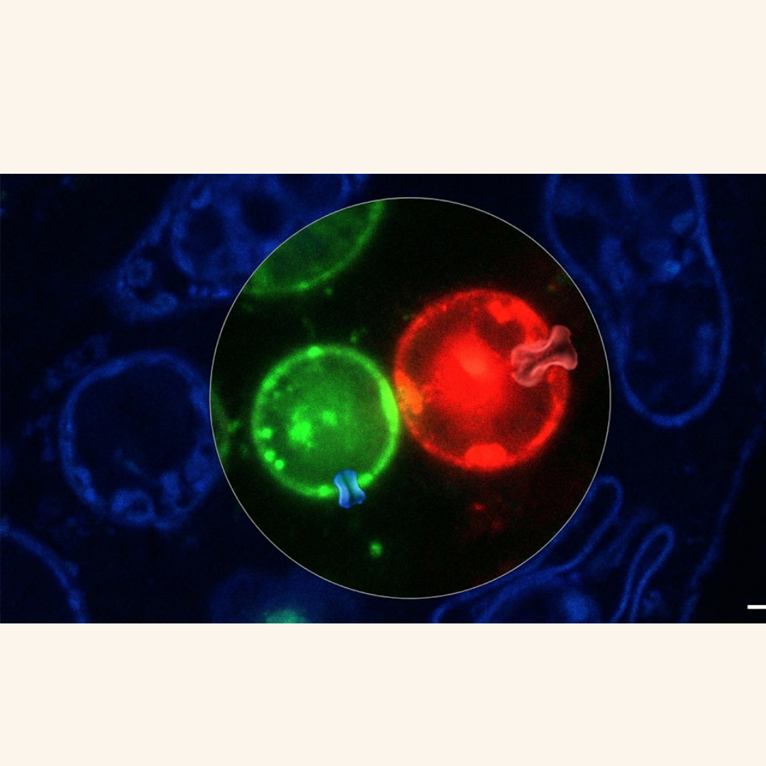 A Tiny "Safety Valve" in Your Cells Could Be the Next Big Drug Target